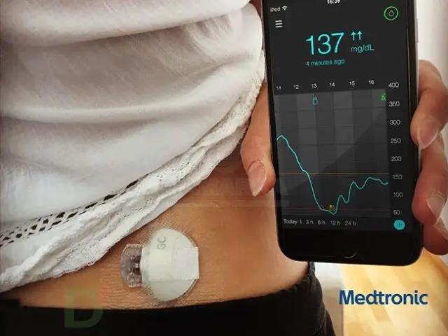 Система непрерывного мониторинга глюкозы Guardian Connect (MMT - 7820)
